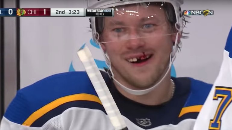 Vladimir Tarasenko gets tooth chopped out, seems weirdly psyched about  going to the dentist | This is the Loop | Golf Digest